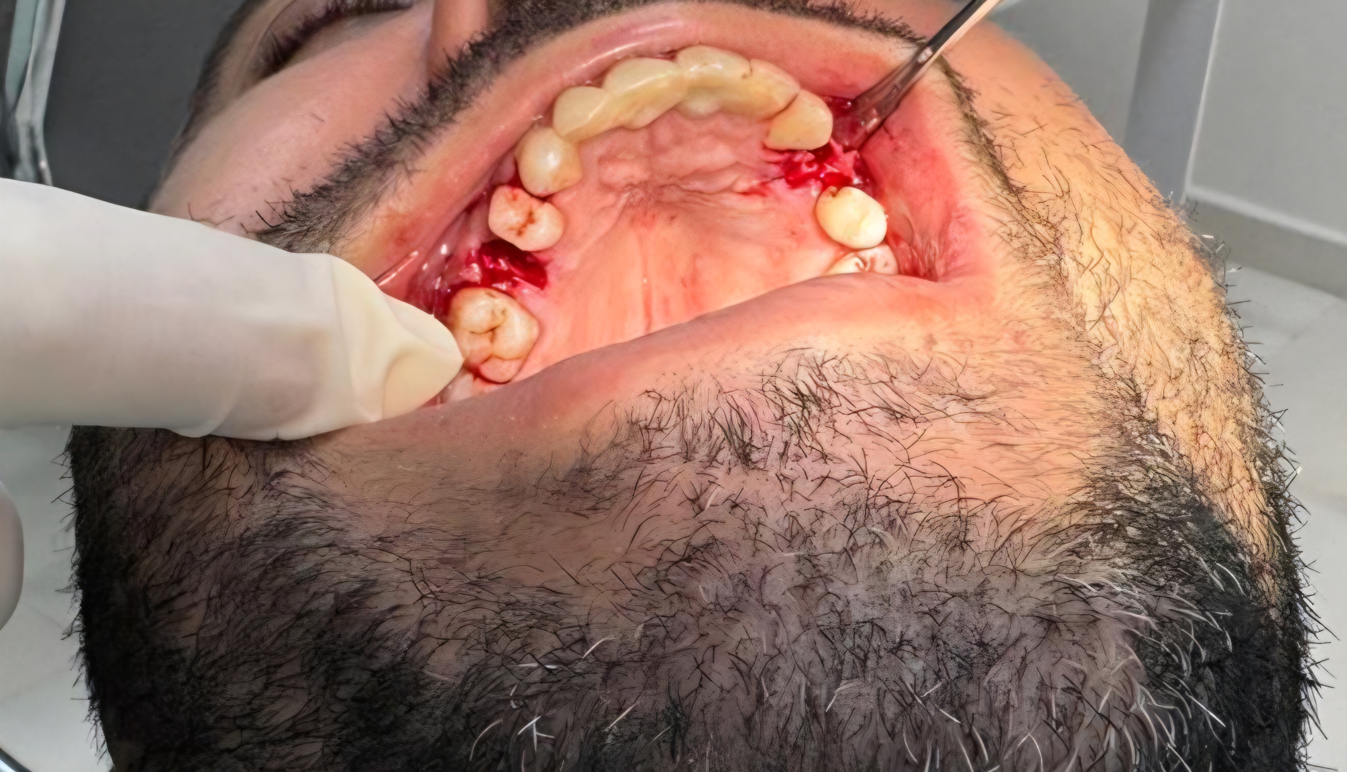 Chirurgie 1