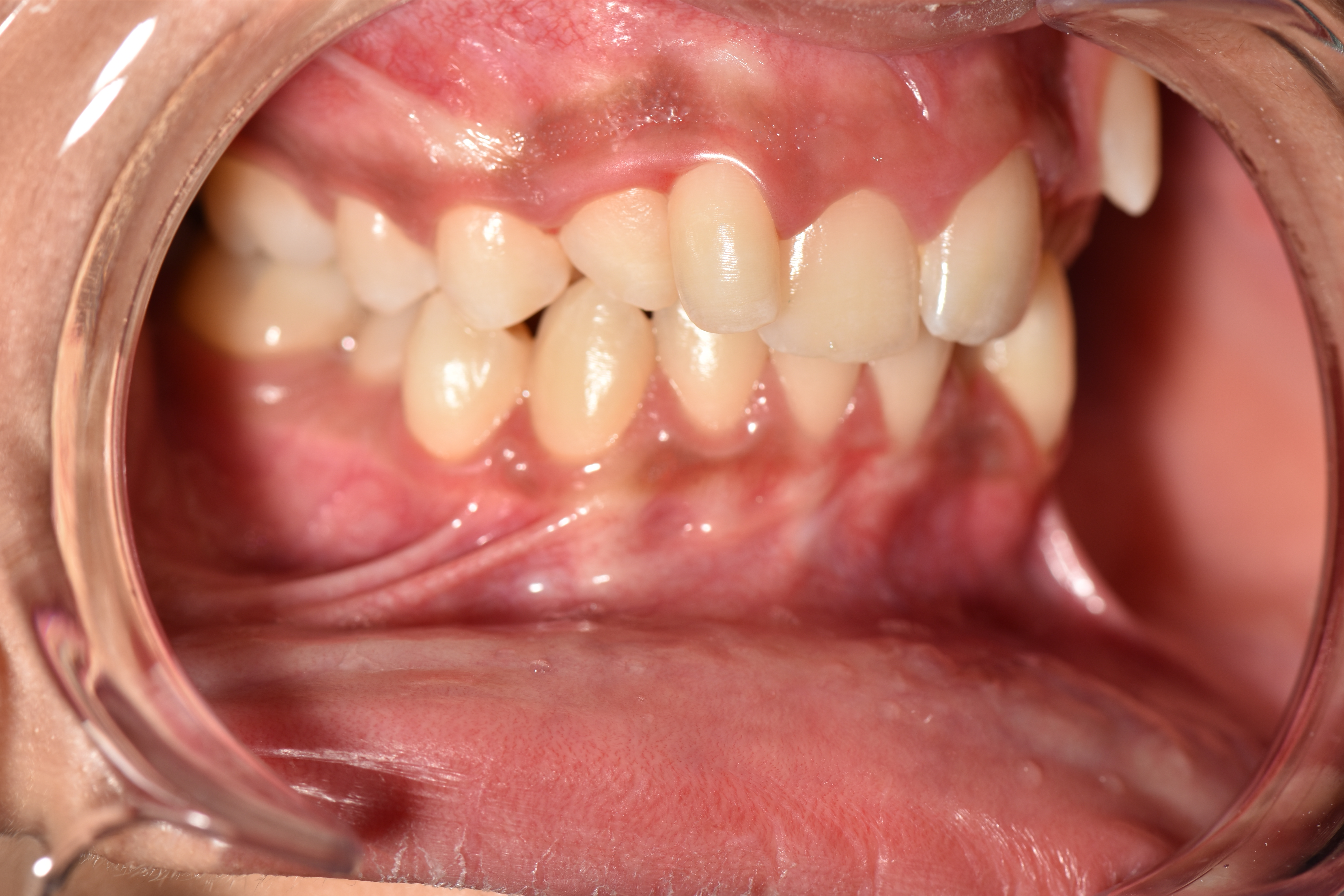 Orthodontie 1