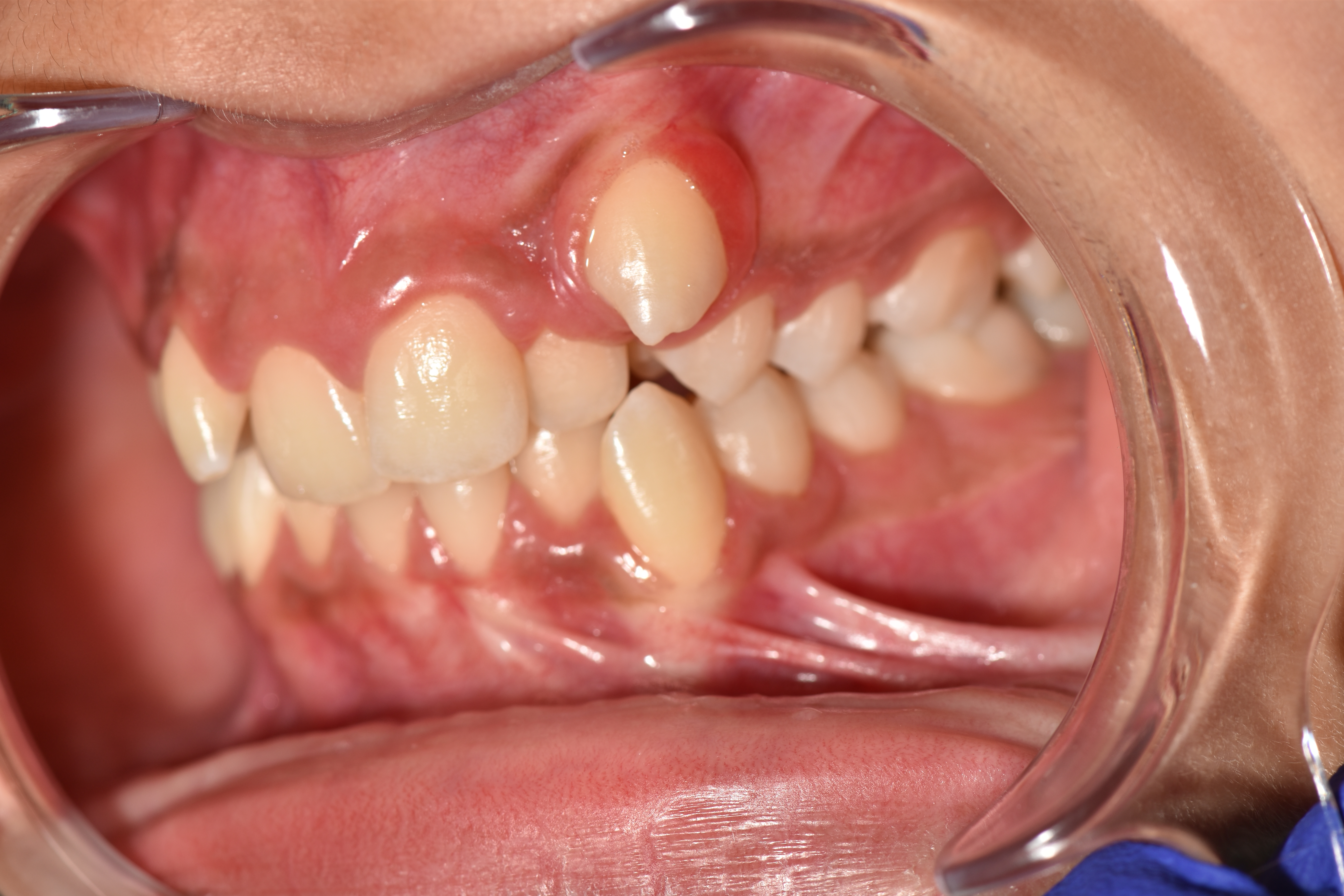 Orthodontie 2