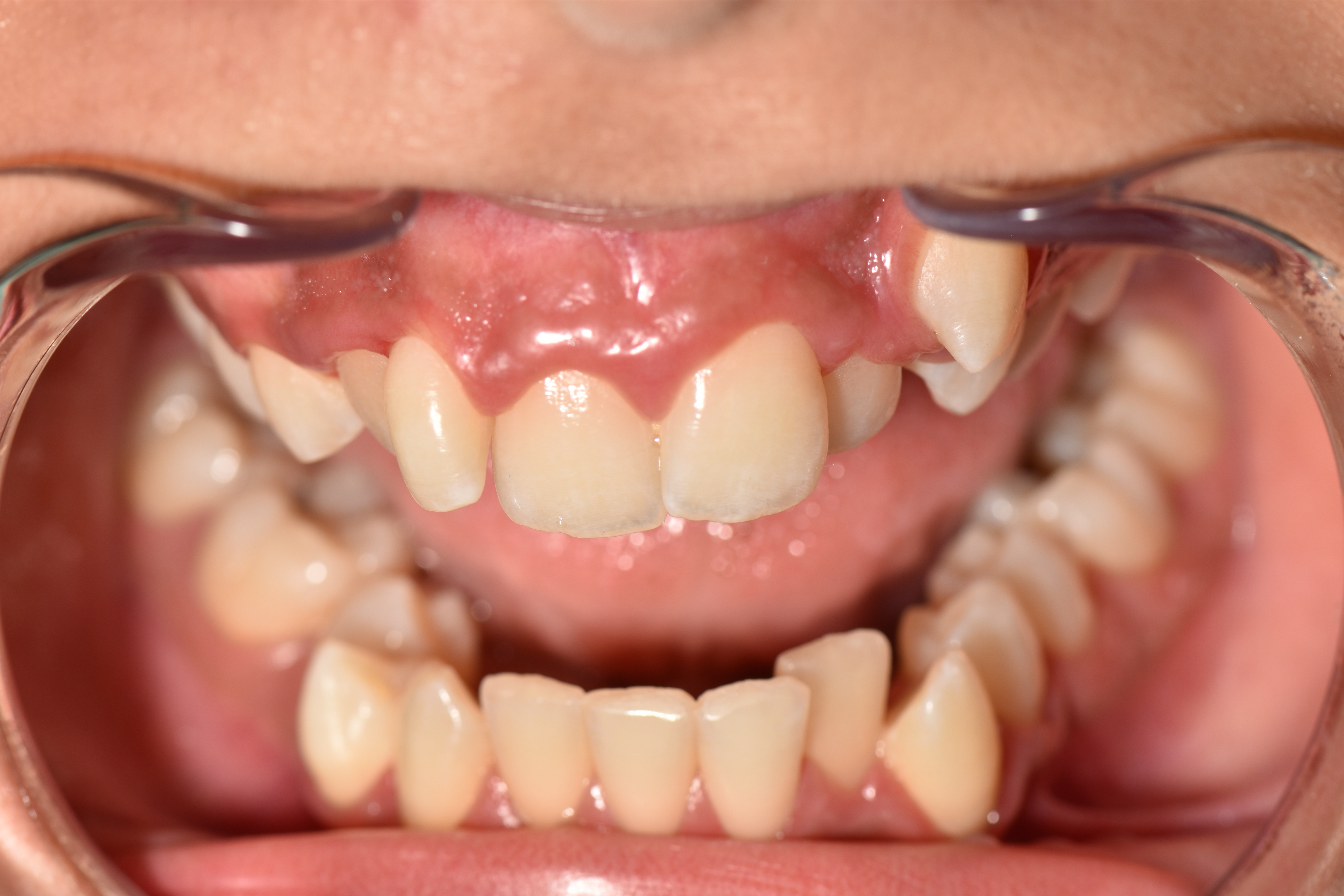 Orthodontie 3