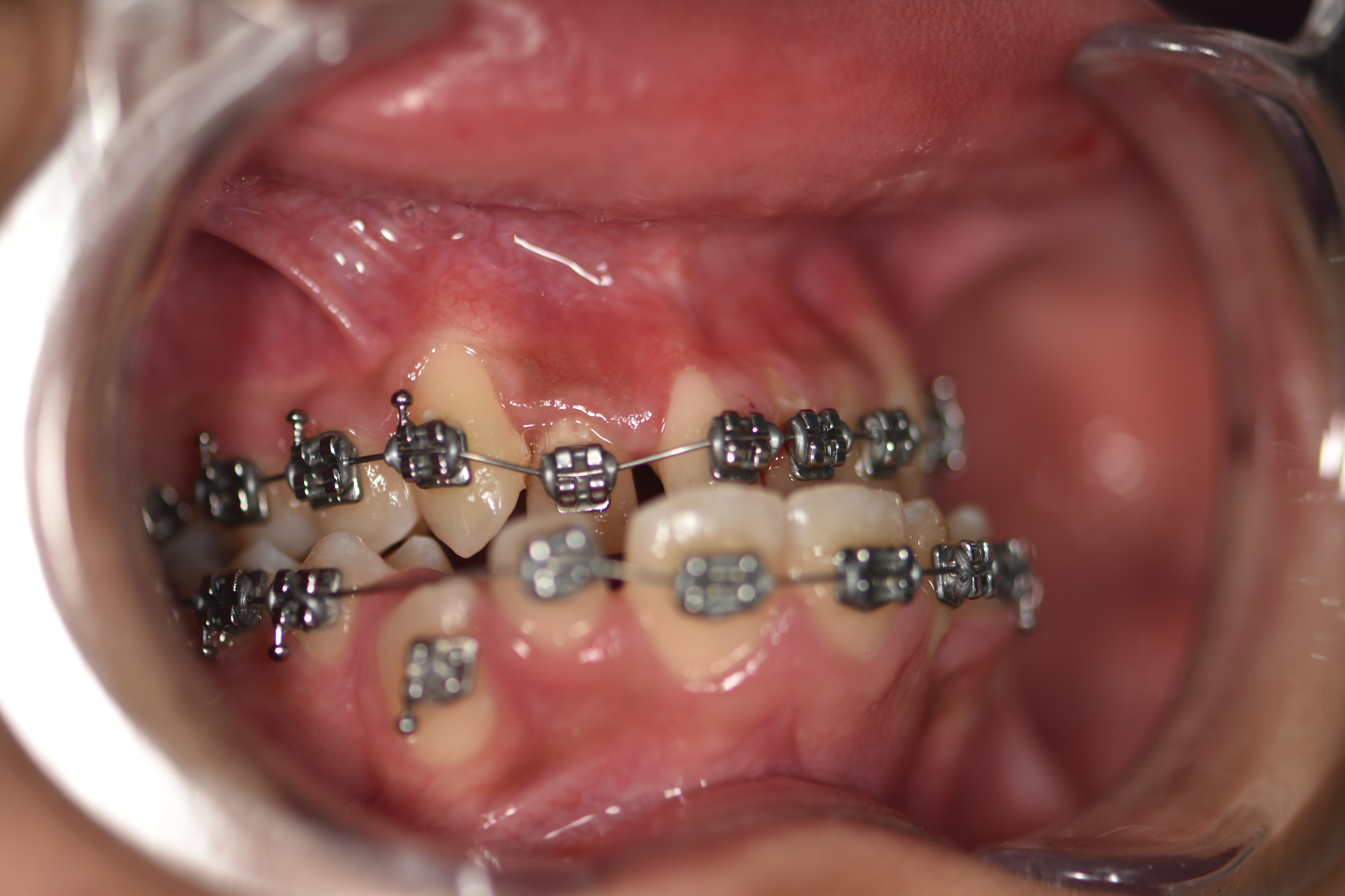 Orthodontie 4