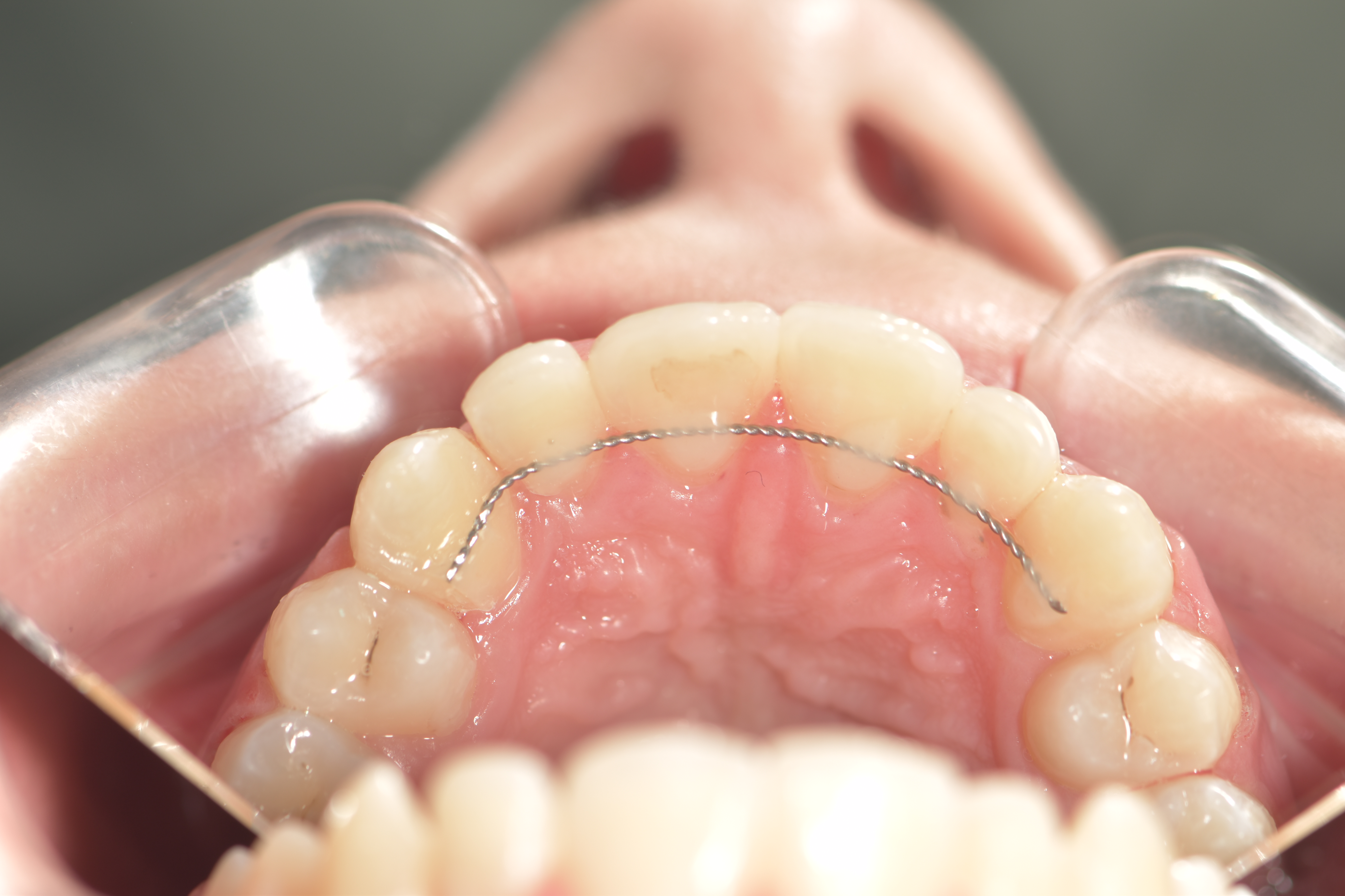 Orthodontie 5