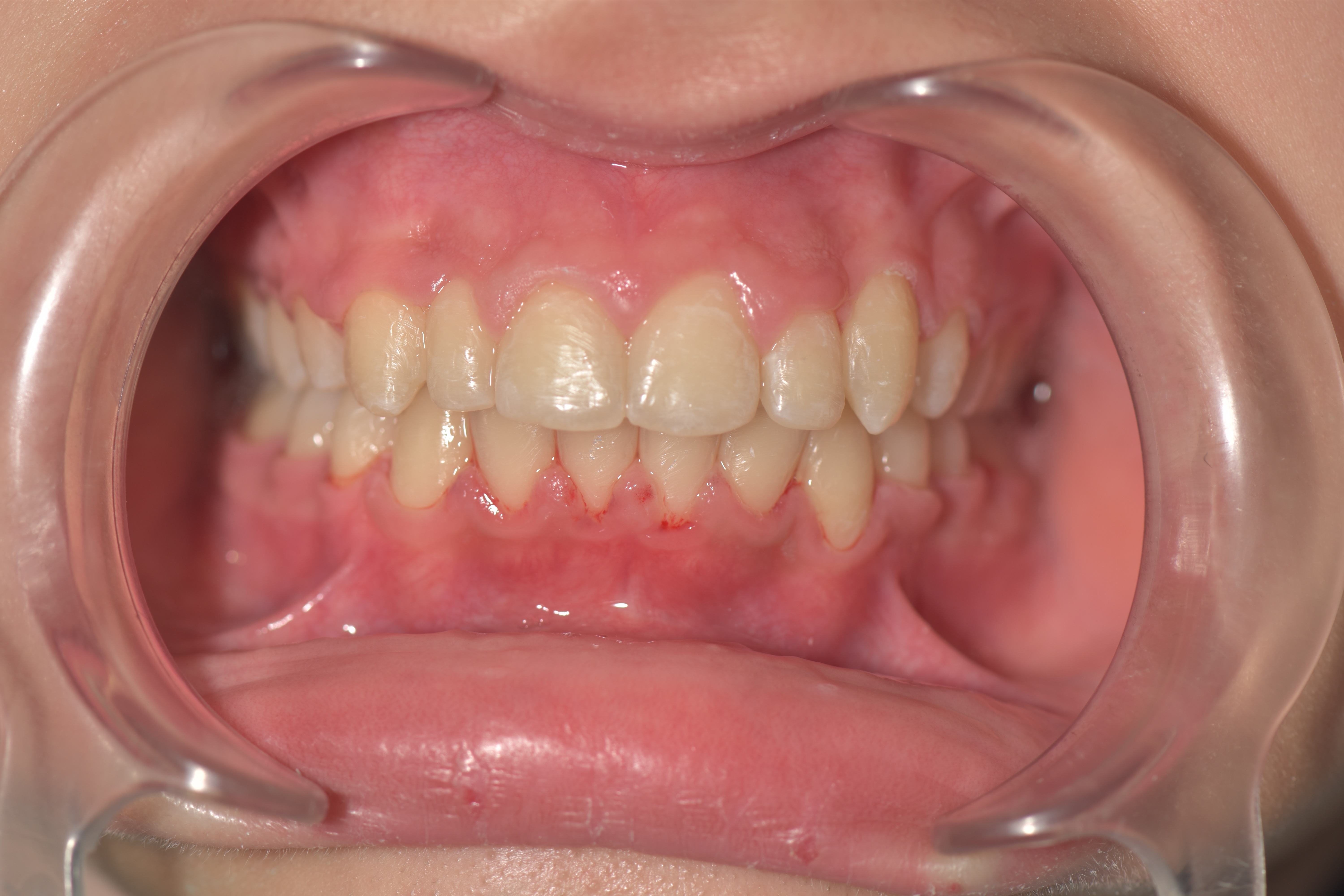 Orthodontie 6