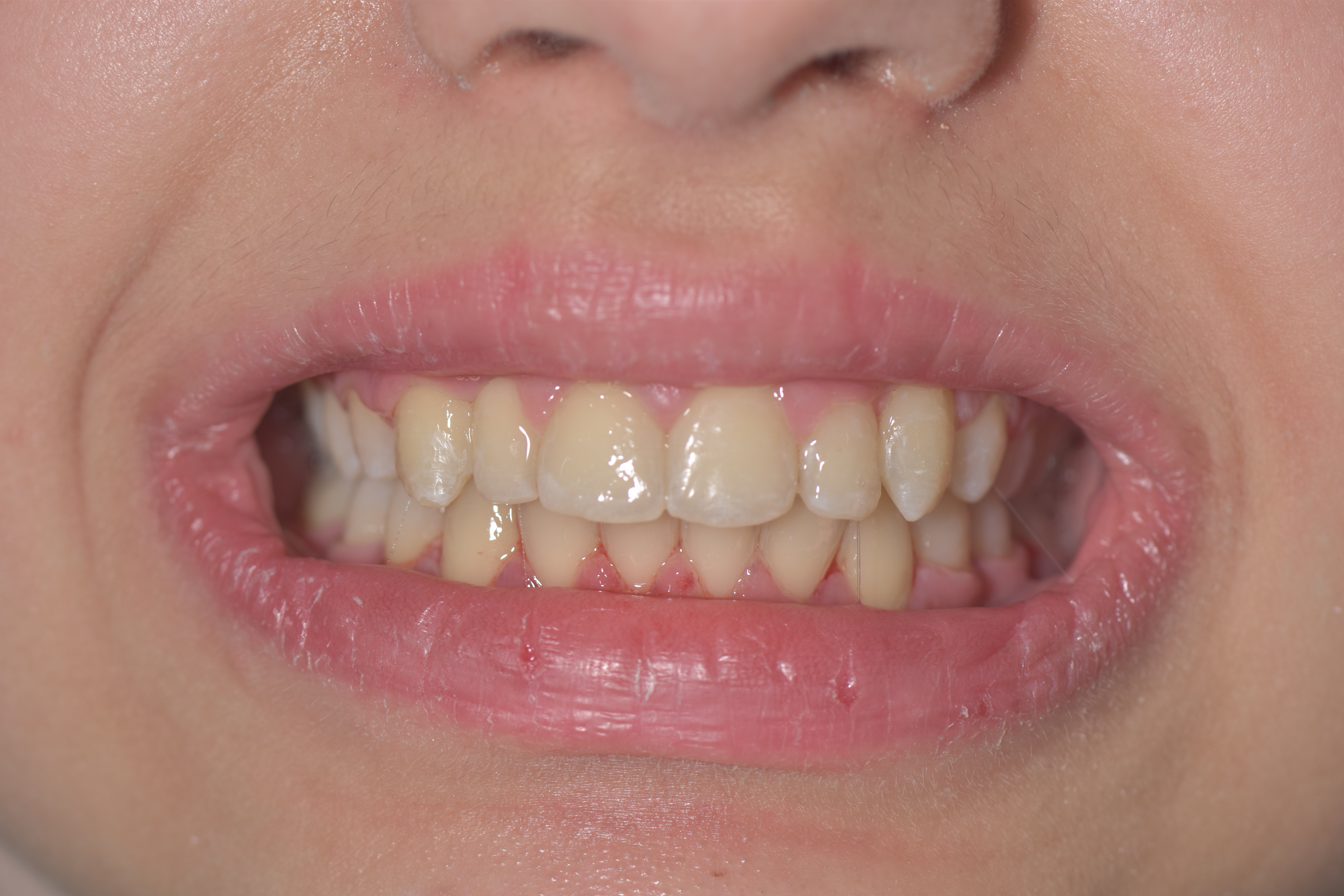 Orthodontie 7